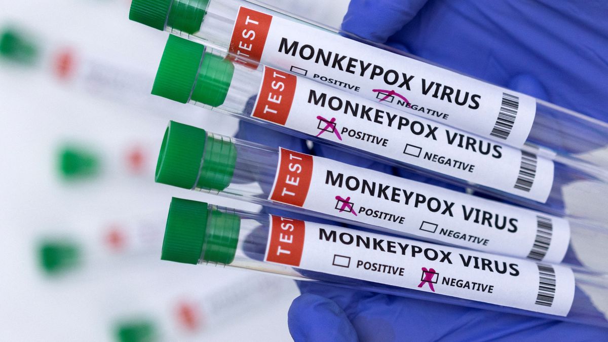 Viruela de mono: Reino Unido amplía la vacunación y recomienda inmunizar a la población homosexual y bisexual