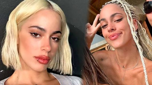 Tini Stoessel se animó a un jugado retoque en el rostro y revolucionó a sus fans