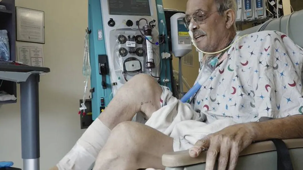 Lawrence Faucette estaba a punto de morir por insuficiencia cardiaca. (Foto: Popular)