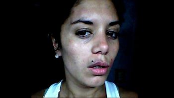 Aparecieron fotos de la ex del Polaco con moretones