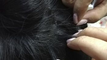 El truco casero que elimina los piojos y que los pediatras recomiendan