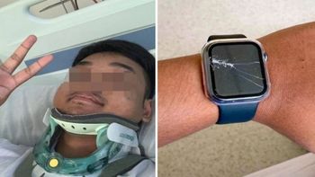 Impresionante: lo atropellaron, estaba a punto de morir, pero una llamada automática de su Apple Watch le salvó la vida