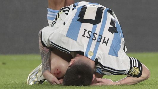 La impactante imagen de la rodilla de Lionel Messi tras un patadón en el duelo de la Selección Argentina contra Panamá