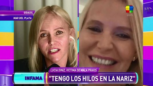 Otra denuncia contra Lotocki: Me miraban y pensaban que había sufrido un accidente”