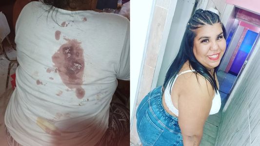 La hermana de Thiago de Gran Hermano 2022 mostró todas las fotos de cómo quedó tras el brutal ataque