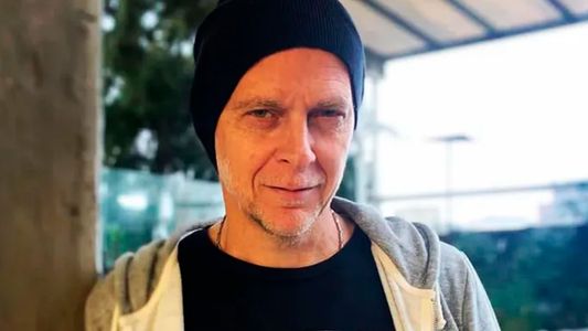 Matías Martin reveló qué retoque estético se realizó