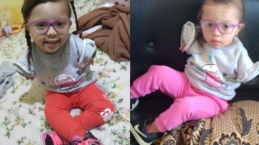 Tiene 3 años y necesita dos prótesis para poder caminar: la conmovedora historia de Liz