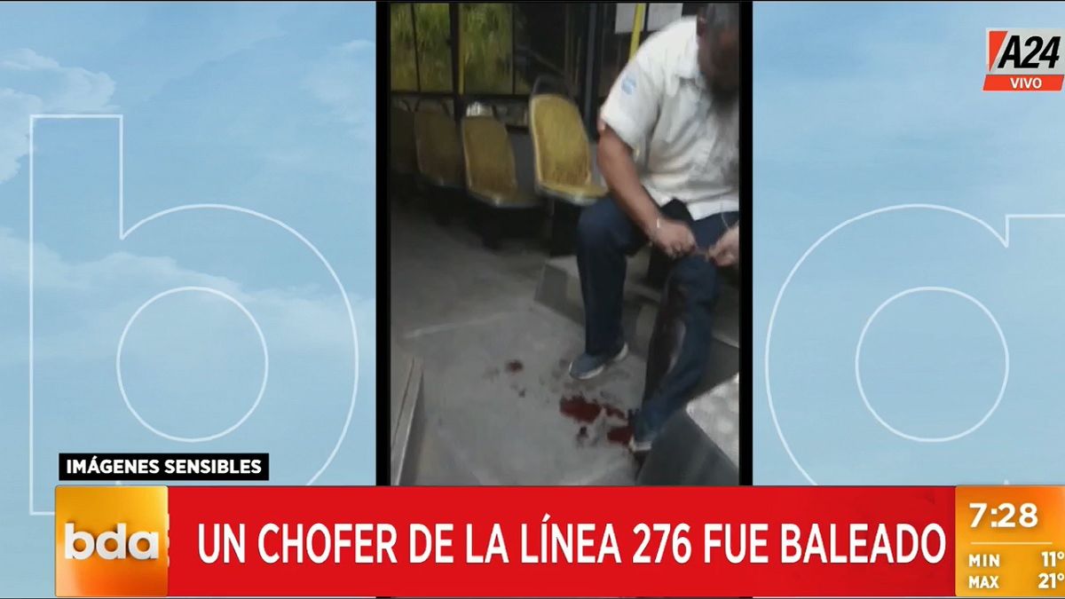 Así quedó el chofer baleado. Foto: captura de Tv.&nbsp;