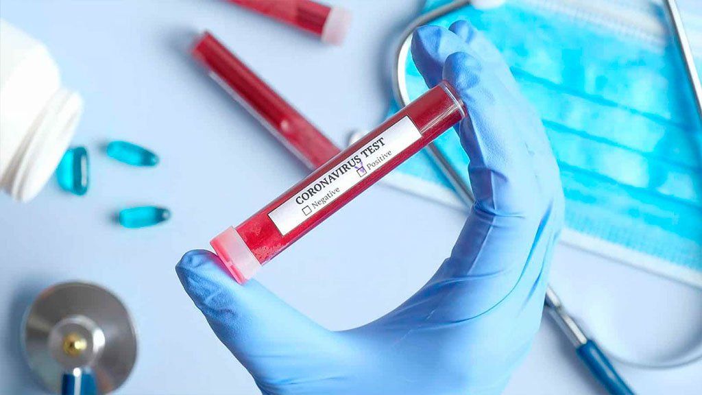 Con 552 nuevos casos, el total de afectados por coronavirus asciende a 12.628, con 467 muertos