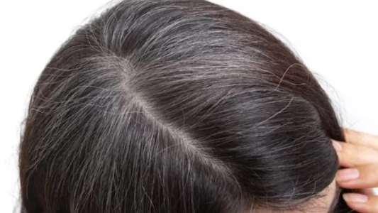 Tres productos naturales que tenés en tu casa para tapar las canas