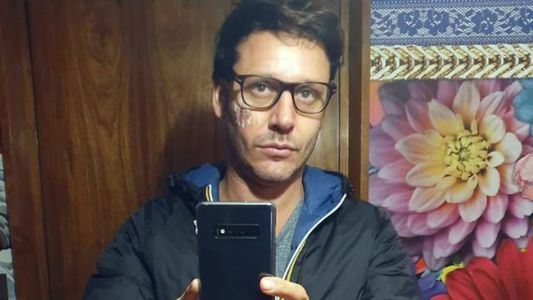 Se supo el origen de la misteriosa cicatriz de Benjamín Vicuña: No se podía mantener de pie