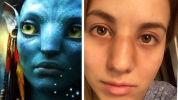 Así le quedó la nariz a Flor Vigna tras el duro golpe en el Bailando