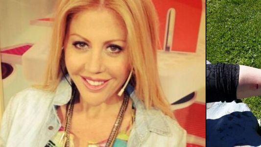 Mal momento para Barbie Simons: fue atacada por dos perros