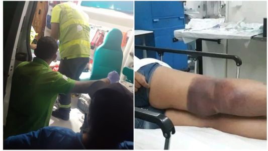 Fue a cargar la Sube, recibió una descarga eléctrica y terminó internada en un hospital de La Plata