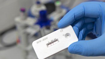 Las clínicas privadas podrán realizar el test de coronavirus sin necesidad de validarlo en el Malbrán