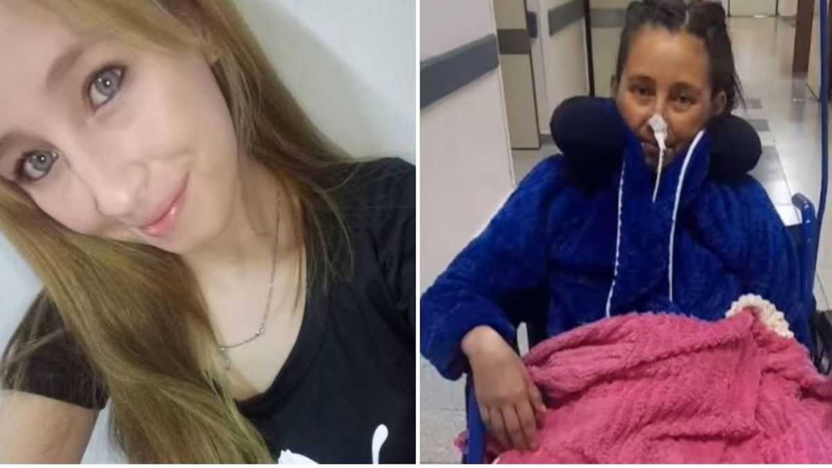 La operación sencilla que se convirtió en pesadilla: la terrible historia de Alison Calfunao. 