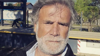 Teto Medina reveló que tiene cáncer de colon y cómo atraviesa el fuerte tratamiento