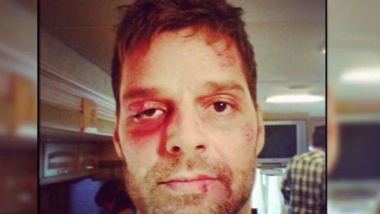 Ricky Martin sorprende con su impactante foto