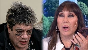 El desesperado llamado de Pity Álvarez a Moria Casán desde el hospital: “Me va a explotar la cabeza”