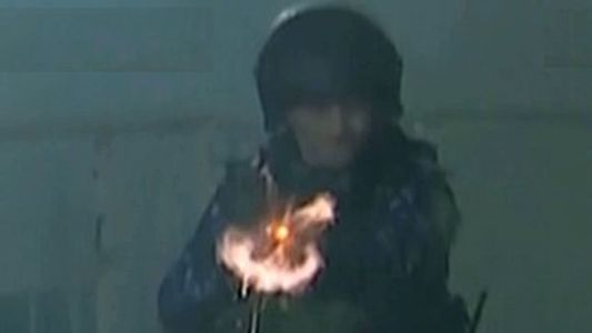 Incidentes en Gimnasia - Boca: la policía baleó e hirió a un camarógrafo