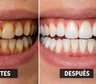 Ni vinagre ni bicarbonato: este es el mejor MÉTODO para eliminar el sarro de los dientes y dejarlos con BRILLO