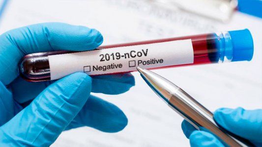 Reporte de COVID-19: en 24 horas se registraron 1.393 contagios y 35 muertos