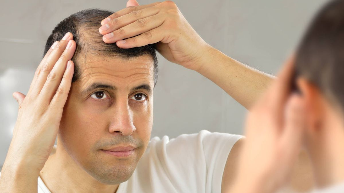 Ca&iacute;a de pelo: evitala con estas vitaminas que encontr&aacute;s en alimentos