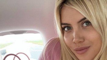 Wanda Nara tuvo una emergencia estética: las fotos
