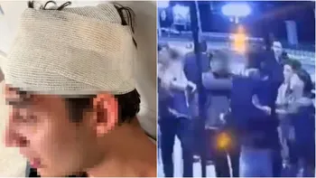 Agustín Salvador Huri fue atacado por un grupo de entre cuatro y cinco personas (Foto: gentileza El Sol).