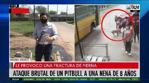 San Miguel: un pitbull atacó a una nena de 8 años y el dueño no aparece