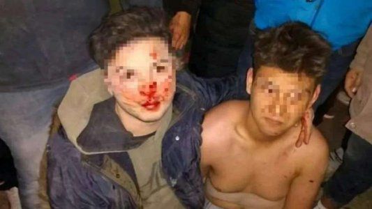 Vecinos linchan a dos chicos acusados de motochorros y le prenden fuego el vehículo