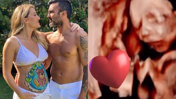 Mica Viciconte compartió una ecografía con la carita de su bebé