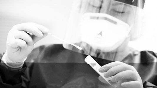 Gonzalo Belloso: Para la Conmebol sólo es válido y obligatorio el hisopado PCR