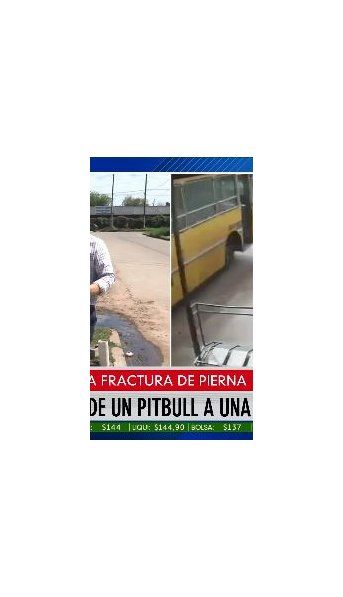 San Miguel: un pitbull atacó a una nena de 8 años y el dueño no aparece