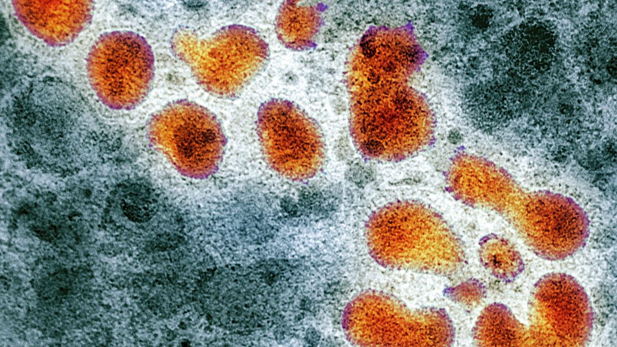 Brote de Gripe H3N2: cuándo llegaría a Argentina y cuál sería su impacto