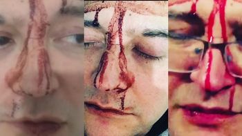 Leo García sufrió una tremenda golpiza de una patota homofóbica