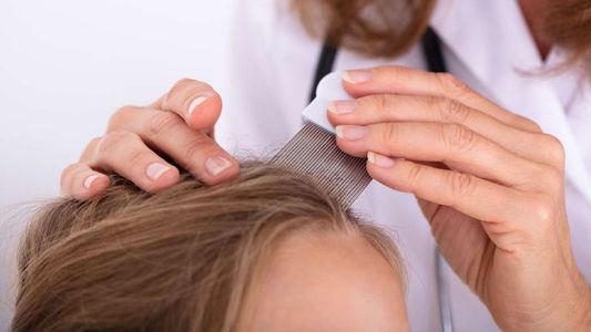 Le saco los piojos: una mujer ofrece un particular servicio para poder llegar a fin de mes