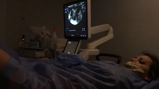 Noelia Marzol y su divertida reacción en su primera ecografía de embarazo: Está re alterado