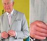 Preocupan los dedos salchicha del Rey Carlos III, ¿cuál es el problema de salud del monarca?