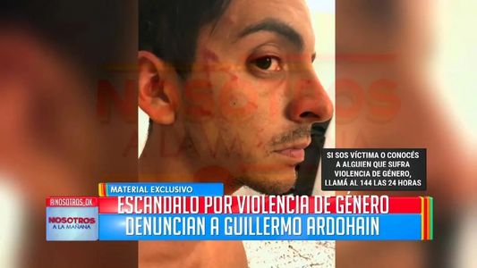 Impactantes fotos del hermano de Pampita: él asegura que también fue agredido por su pareja