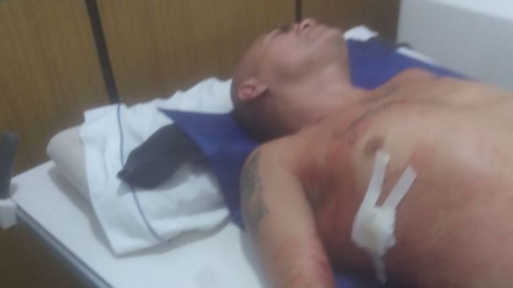 Apuñalan al ex boxeador Rodrigo La Hiena Barrios tras una pelea en una fiesta