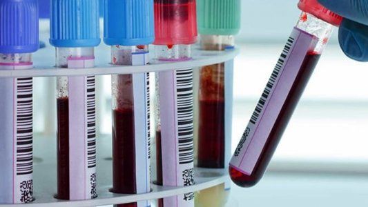 Un estudio reveló cuáles son los tipos de sangre más vulnerables y más resistentes al coronavirus