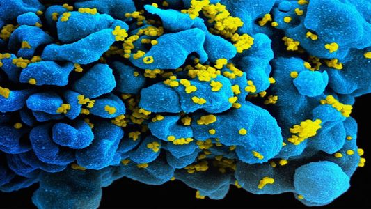 Descubren una nueva variante del HIV, más contagiosa: ¿por qué todavía no hay una vacuna?