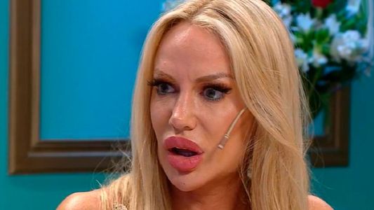 Una doctora enumeró y mostró cuales son las nuevas cirugías que se hizo Luciana Salazar: Rostro arruinado