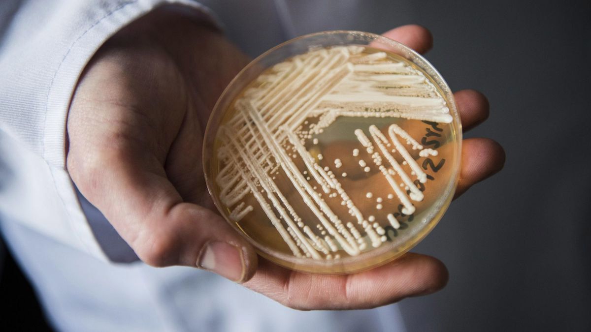 Candida Auris el hongo que resiste a los fármacos y es una amenaza contra la salud más allá de la pandemia (Foto: AP).