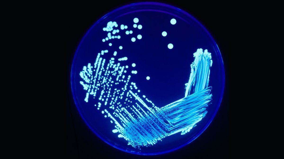 La Legionella es la bactaria causante de las muertes en Tucumán (Foto: Wikipedia).