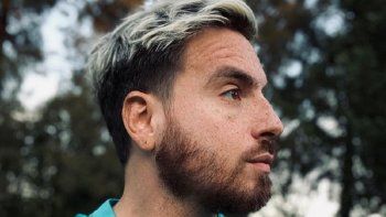 El nuevo look de Federico Bal tras culminar la primera parte de su tratamiento contra el cáncer