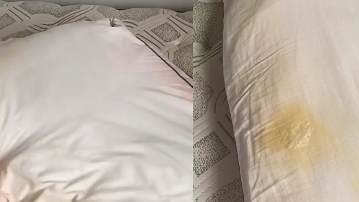 Mostró el truco definitivo para sacarle las manchas amarillentas a las almohadas&nbsp;