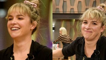 Sofía Pachano sufrió una terrible quemadura y mostró cómo le quedó la mano