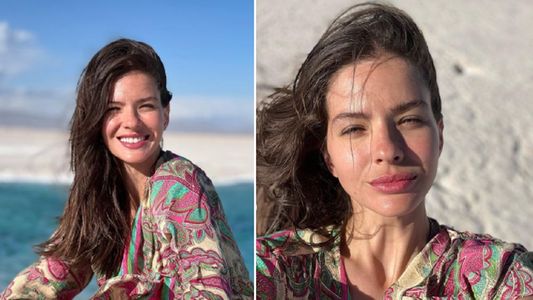 La China Suárez se lastimó y mostró las heridas de guerra